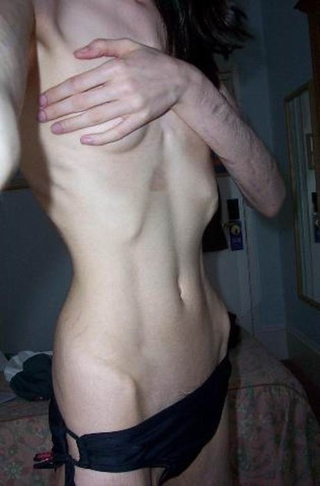 skinny anorexic girls posing and fucking #67245928