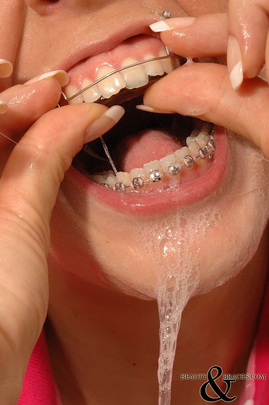 Beauté avec un appareil dentaire en métal mouillé et brillant se brossant négligemment les dents.
 #72757703