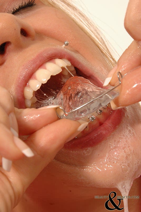 Babe in shiny wet metal mouth braces sloppily brushing her teeth #72757710