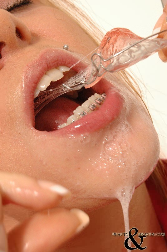 濡れた金属製の歯列矯正具をつけて歯磨きをしている女の子
 #72757713
