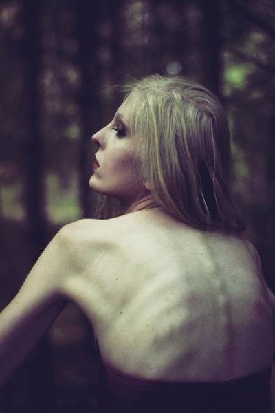 Chicas delgadas mostrando sus cuerpos anoréxicos
 #78732709