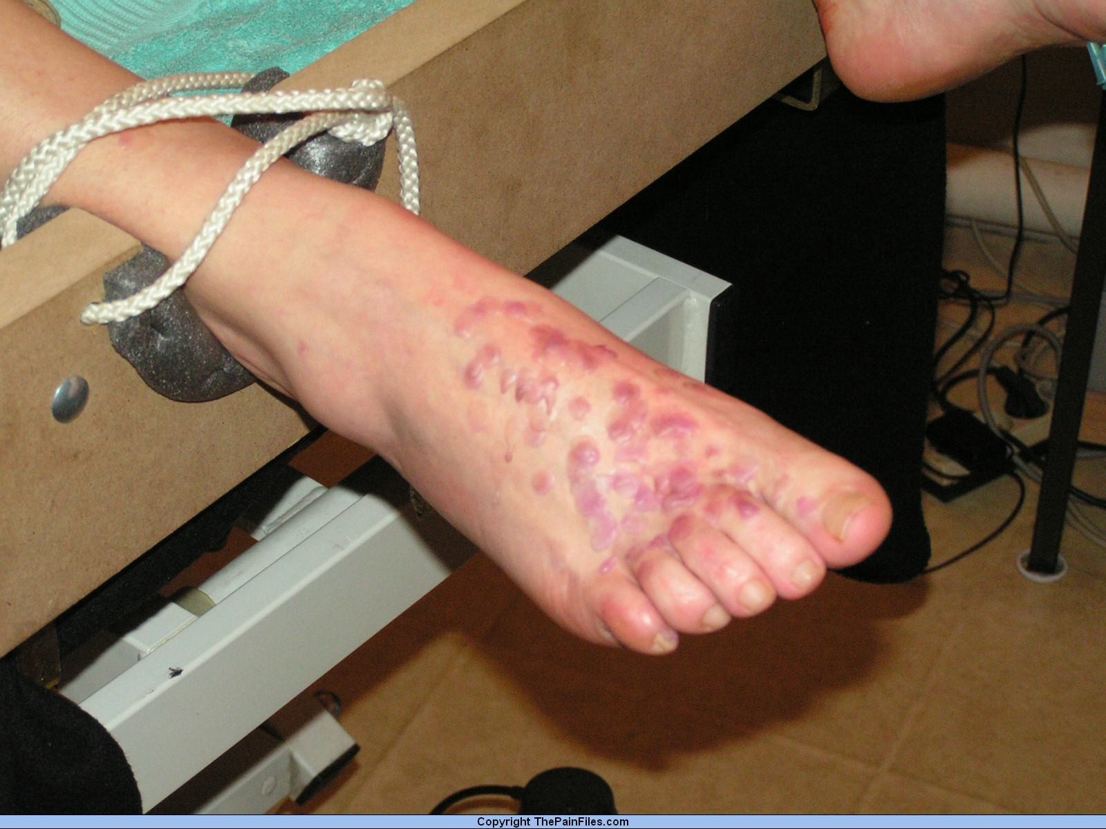 素人の奴隷少女が針で痛めつけられ、足を痛めつけられる
 #72201498