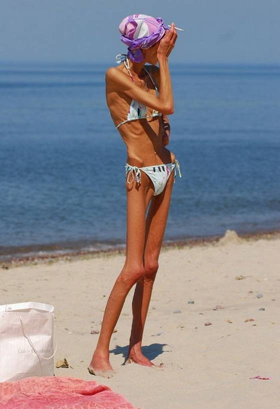 Flacas anoréxicas posando desnudas por comida
 #76488969