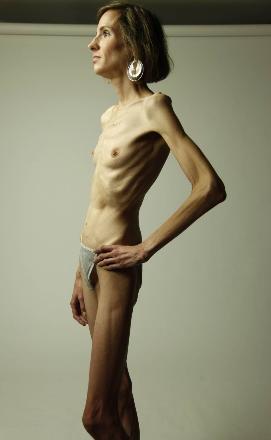 痩せた拒食症の女の子が食べ物のために裸でポーズをとる
 #76489082
