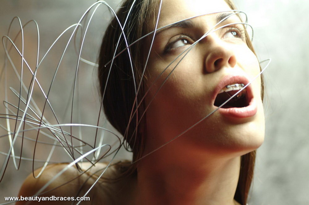 Nude blonde teen with braces has her head wrapped in wire #73258995