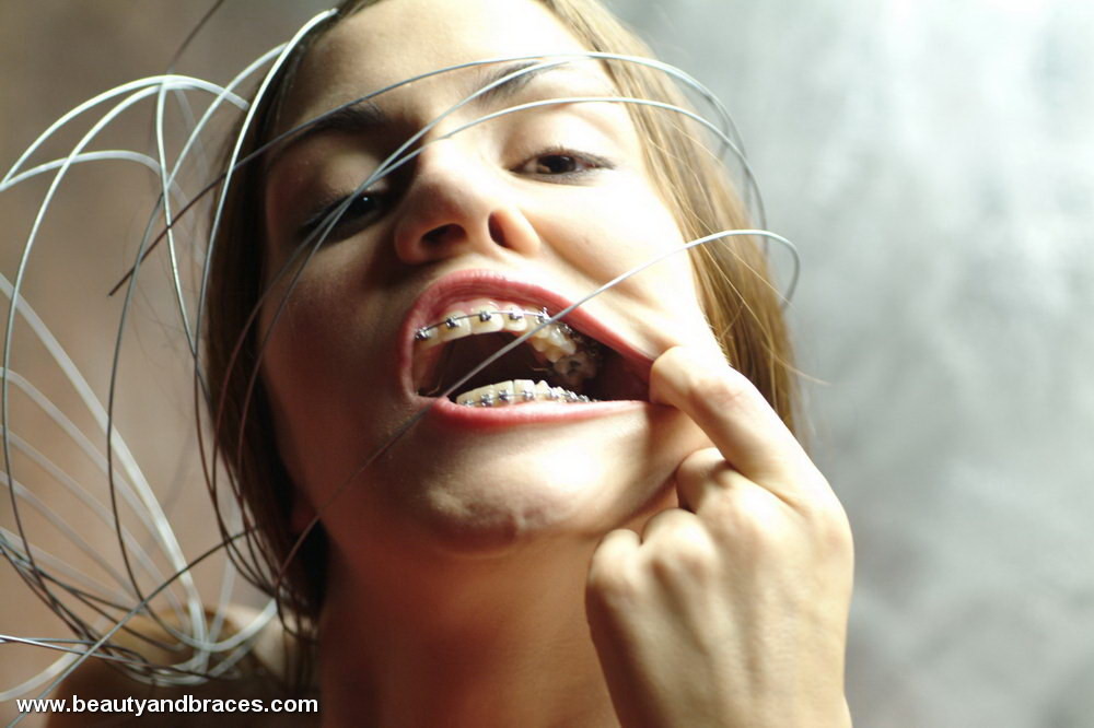 Nude blonde teen with braces has her head wrapped in wire #73259024