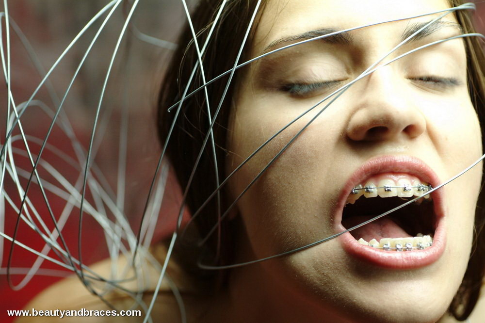 Nude blonde teen with braces has her head wrapped in wire #73259036