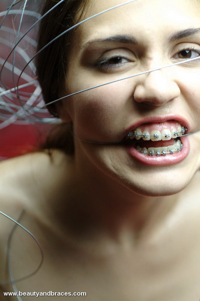 Nude blonde teen with braces has her head wrapped in wire #73259042