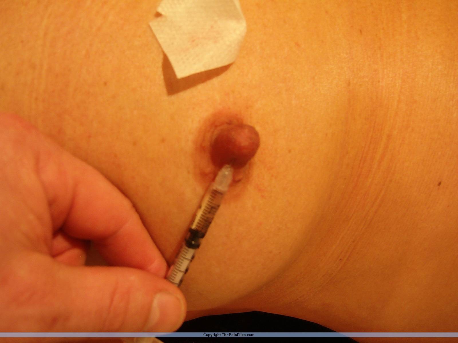 Extreme play piercing pain and saline injection torments for the german amateur  #72181382