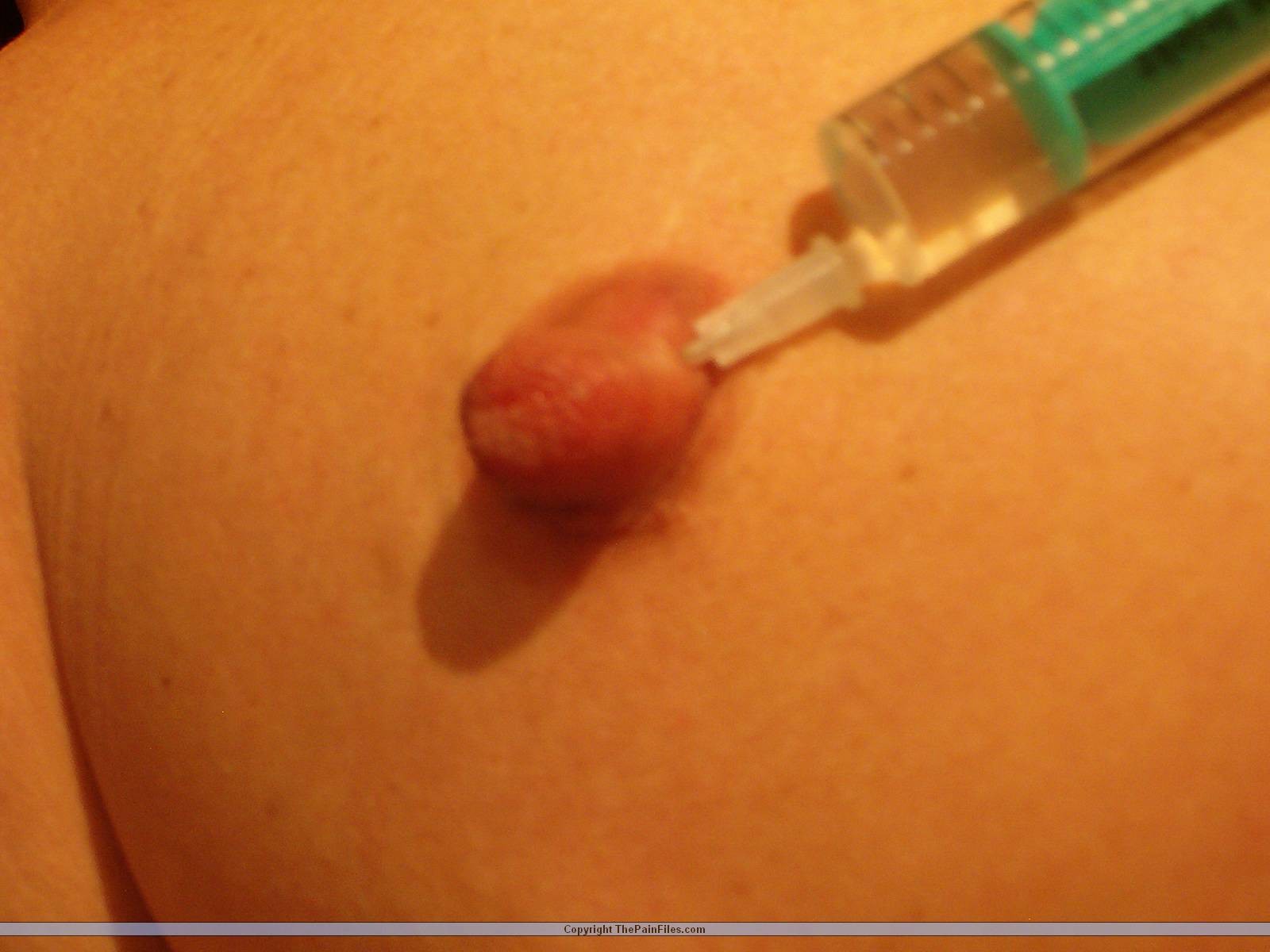 Extreme play piercing pain and saline injection torments for the german amateur  #72181395