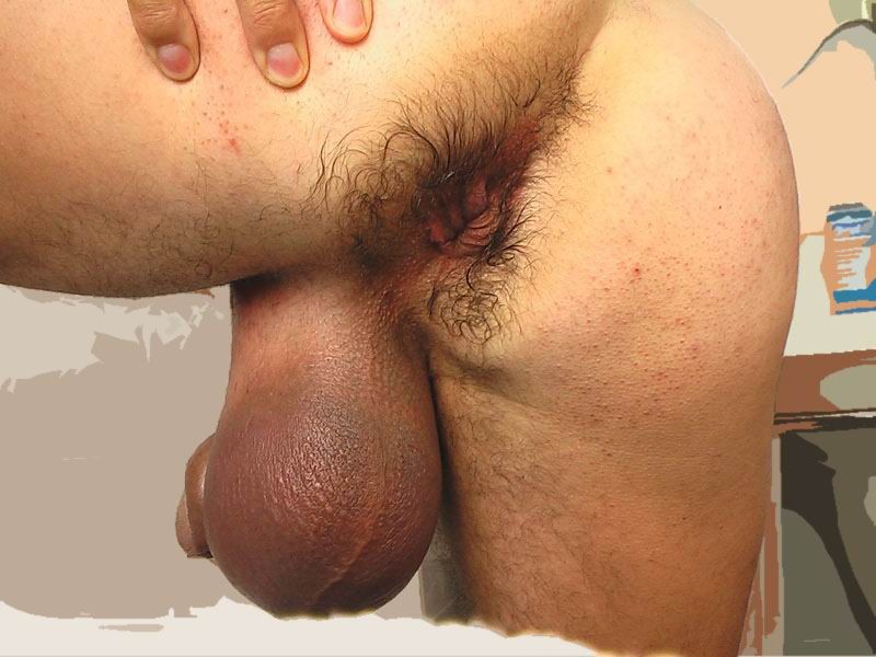 extremely pumped cocks and balls #73233172