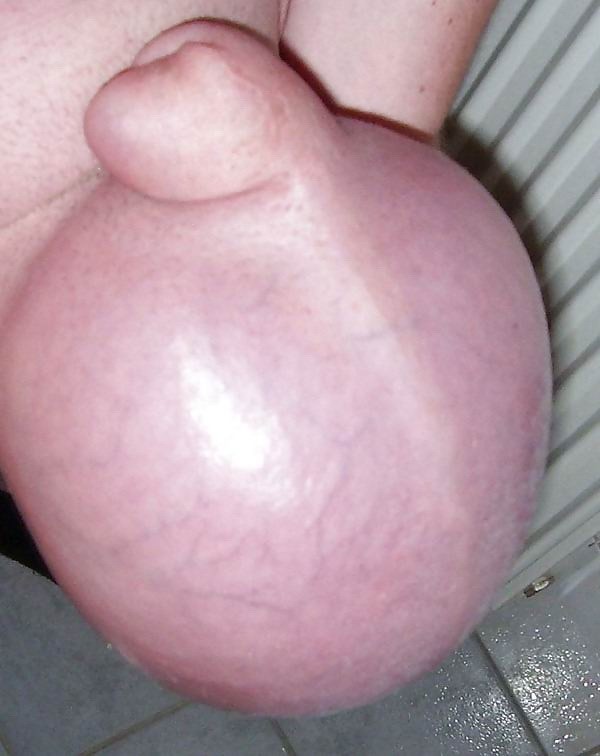 Un tipo mostrando sus enormes bolas salinas
 #73224013