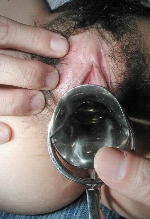 Inserimenti estremi di speculum
 #75608793