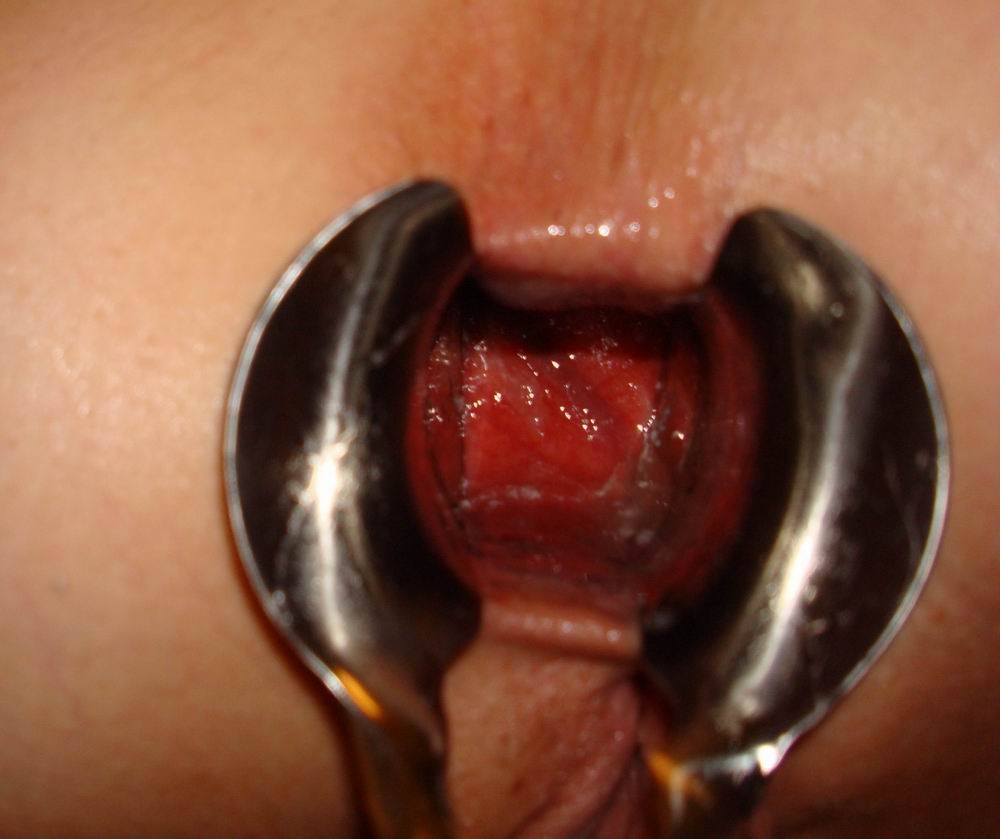 extremely gaping ass and pussy holes #68634295