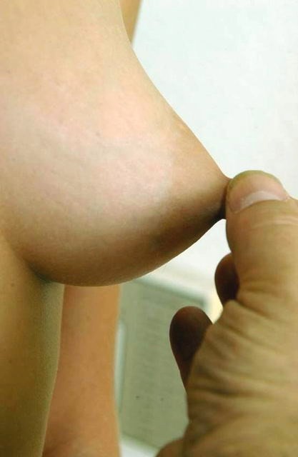 Examen des seins dans un hôpital gynécologique
 #67684915