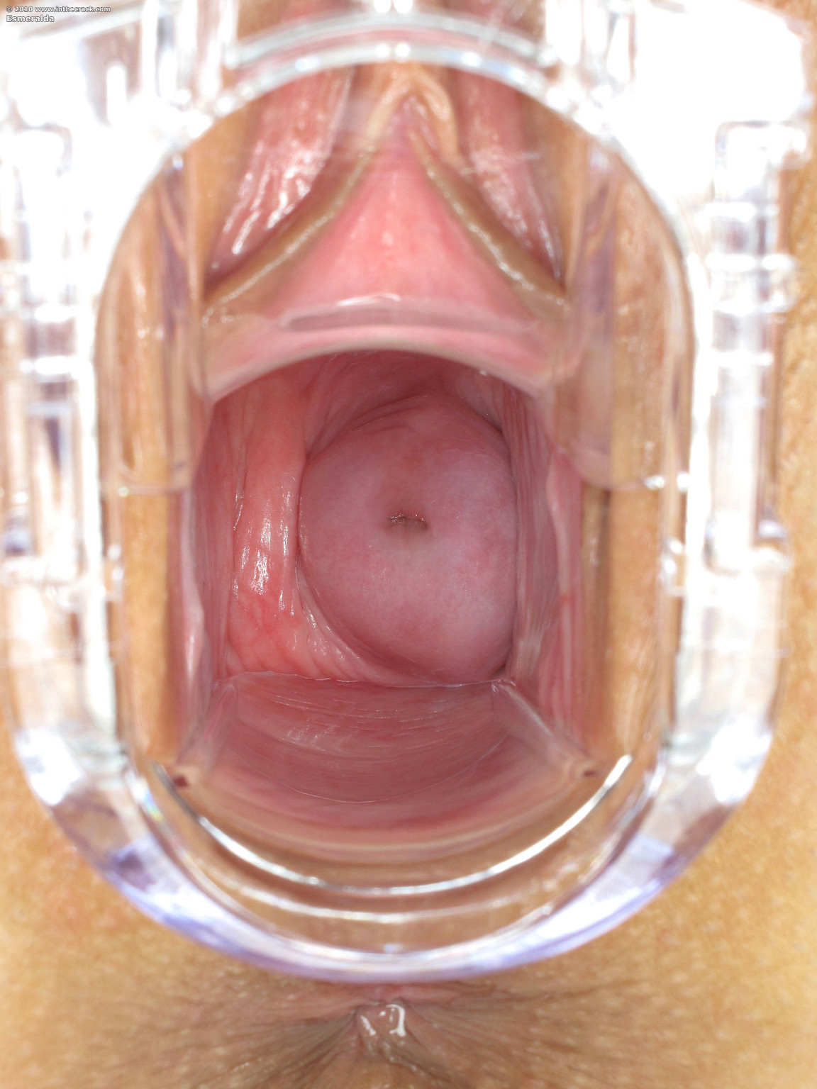 Bubble butt brunette plays with fingers a dildo and a speculum #70411611