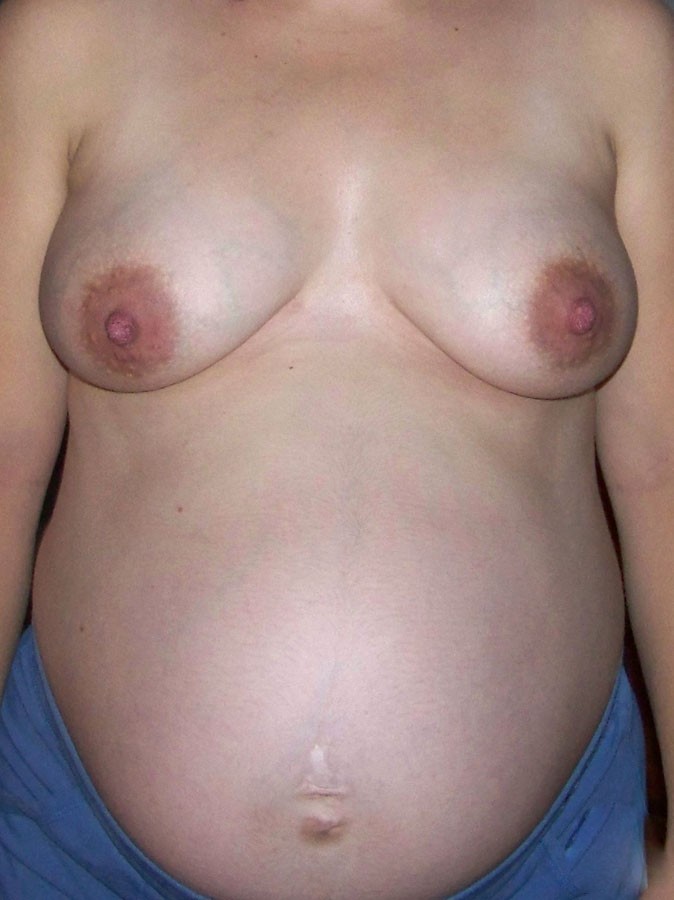 Pregnant amateur girlfriends nude #67694825