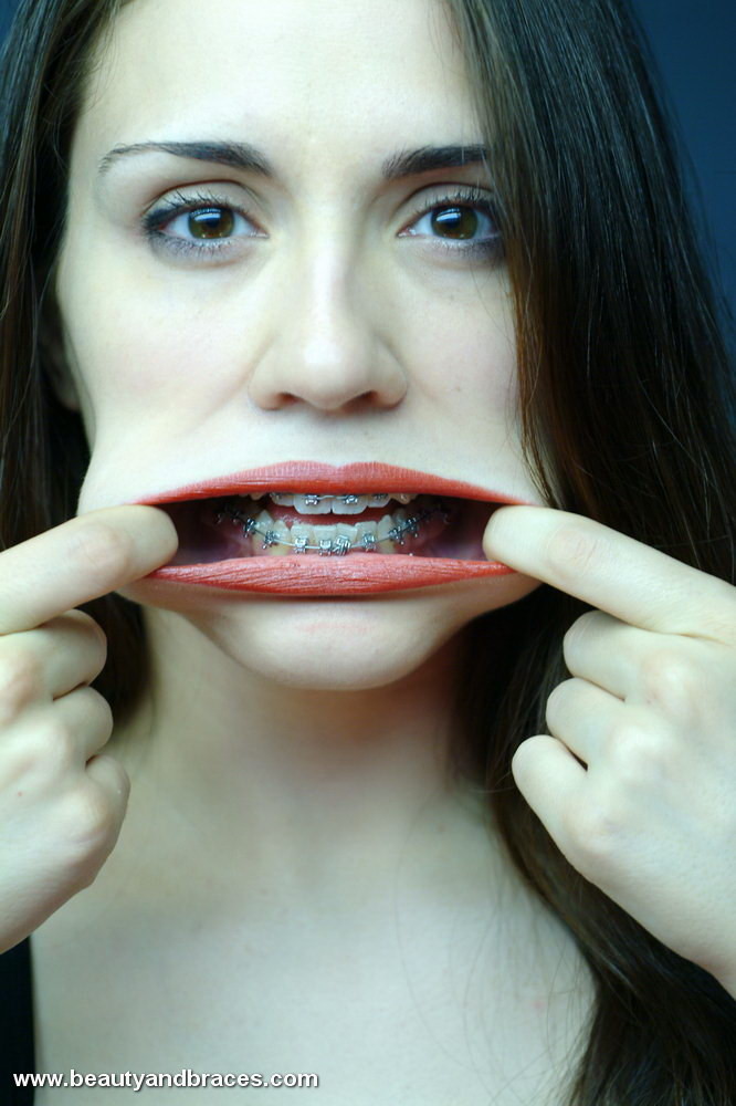 Une jeune brune mignonne avec un appareil dentaire étire sa bouche grande ouverte.
 #74897945