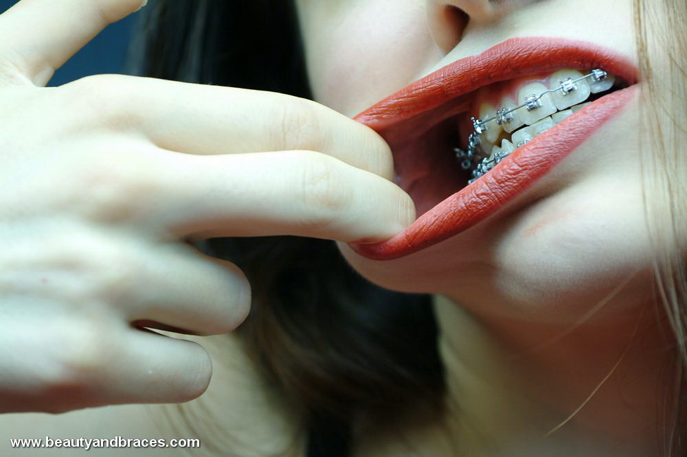 歯列矯正をしたかわいいブルネットのティーンが大きく口を開ける
 #74897949