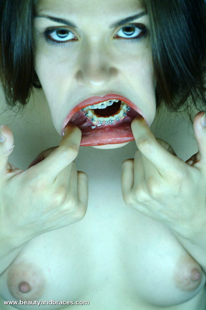 Une jeune brune mignonne avec un appareil dentaire étire sa bouche grande ouverte.
 #74898010