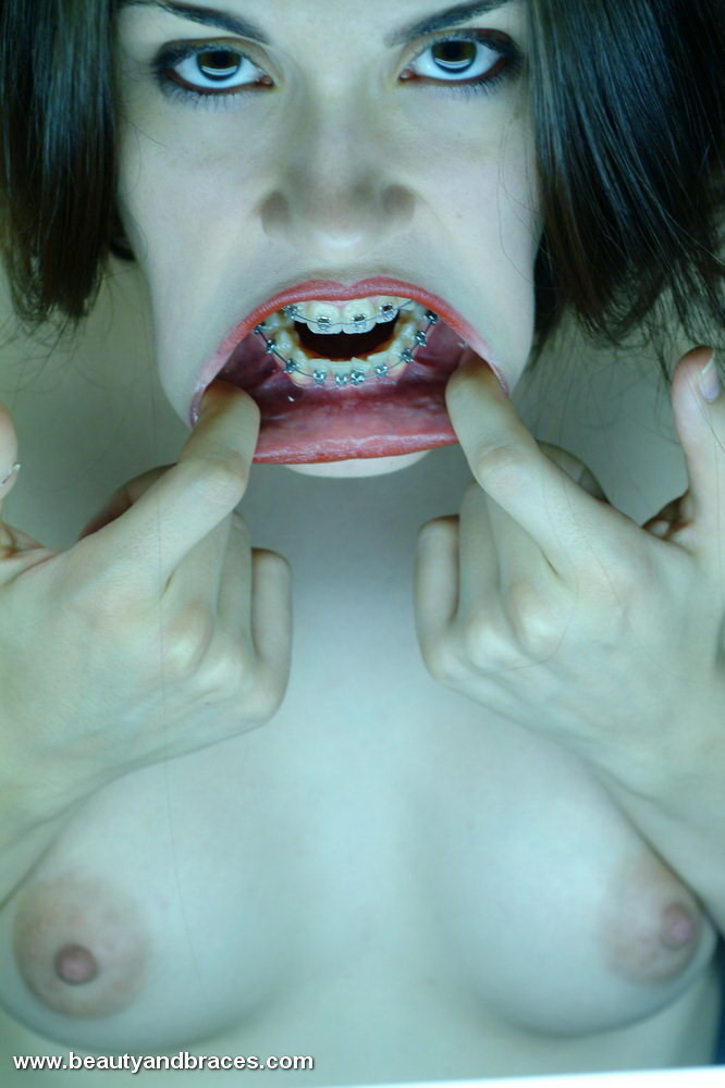 Une jeune brune mignonne avec un appareil dentaire étire sa bouche grande ouverte.
 #74898014