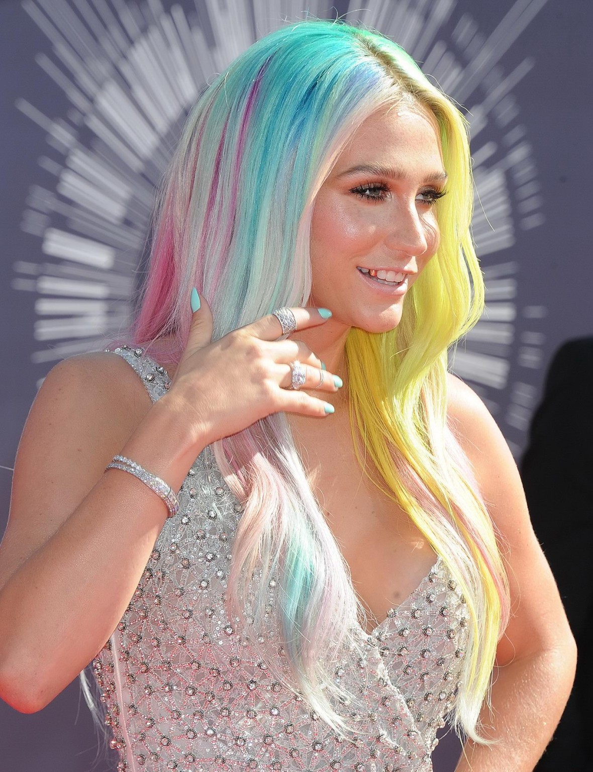 Kesha showing huge cleavage at the 2014 MTV Video Music Awards in Inglewood #75186986