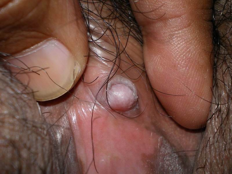 Clítoris y labios vaginales enormes
 #73230598