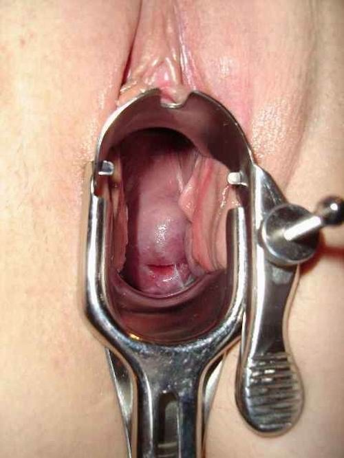 extremely speculum playing #73255863