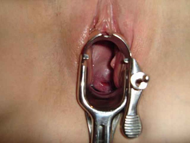 extremely speculum playing #73255902