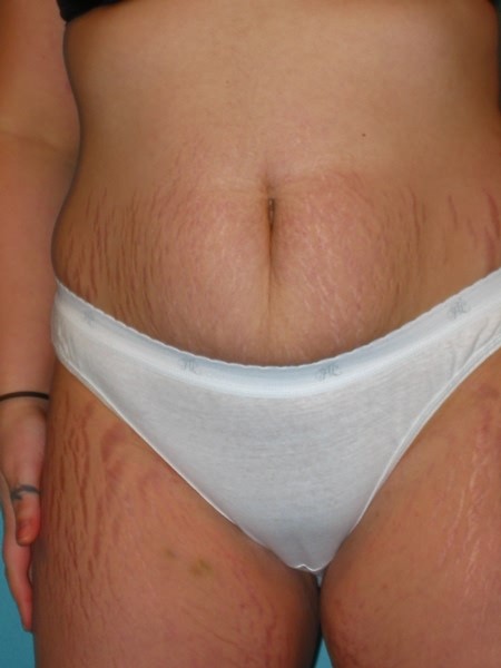 Toy fucking Fatty #75593716
