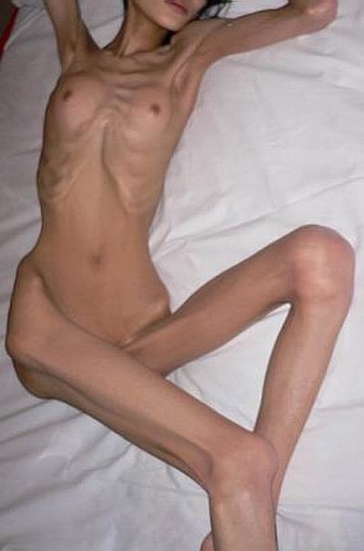 Chicas flacas anoréxicas posando desnudas para la comida
 #76489349
