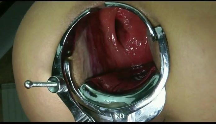 extreme anal fisting and speculum insertions #68599123