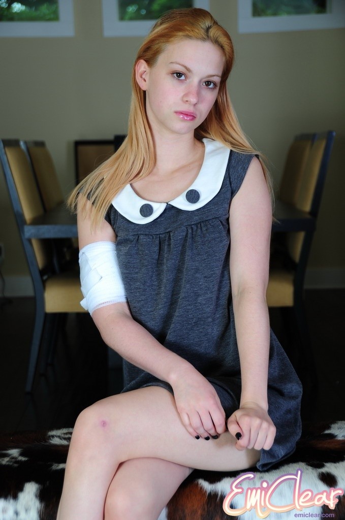 Teen with bandaged arm #78641853