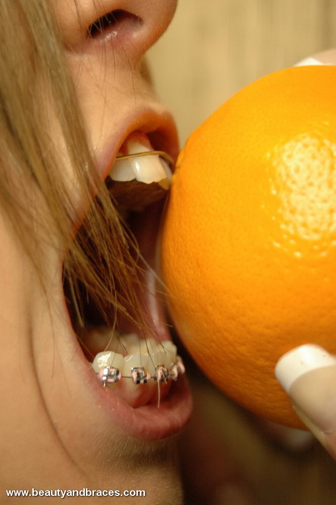 Rubia con ortodoncia se hace un lío devorando una naranja
 #73259335
