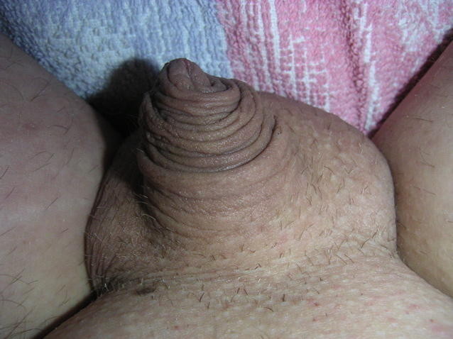 extremely small cocks #73232809