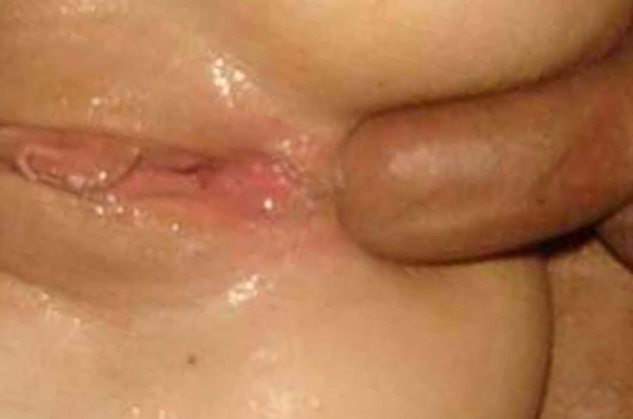 Picture gallery of bitches getting their buttholes drilled #68828115