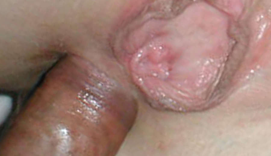 Picture gallery of bitches getting their buttholes drilled #68828129