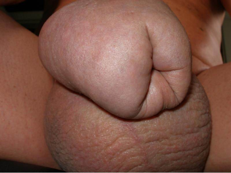 Weird cocks #73235403